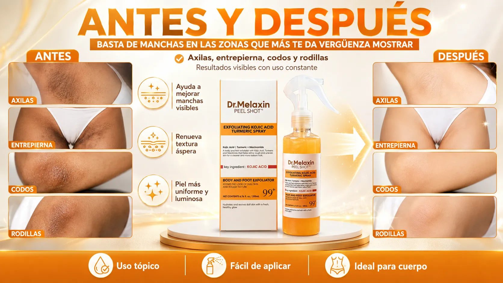 Antes y Después